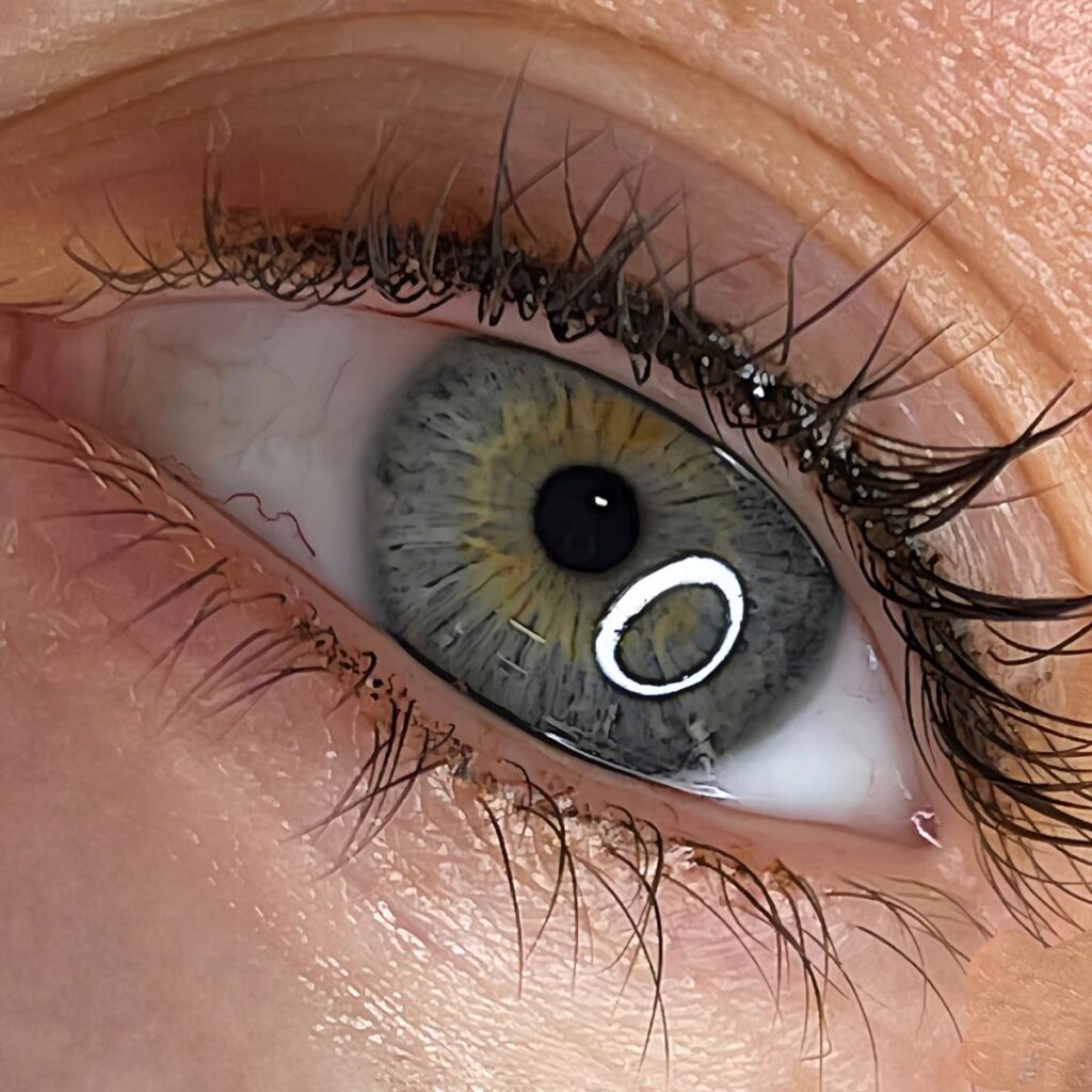 A close up of a woman's eye with a circle in it, depicting home.