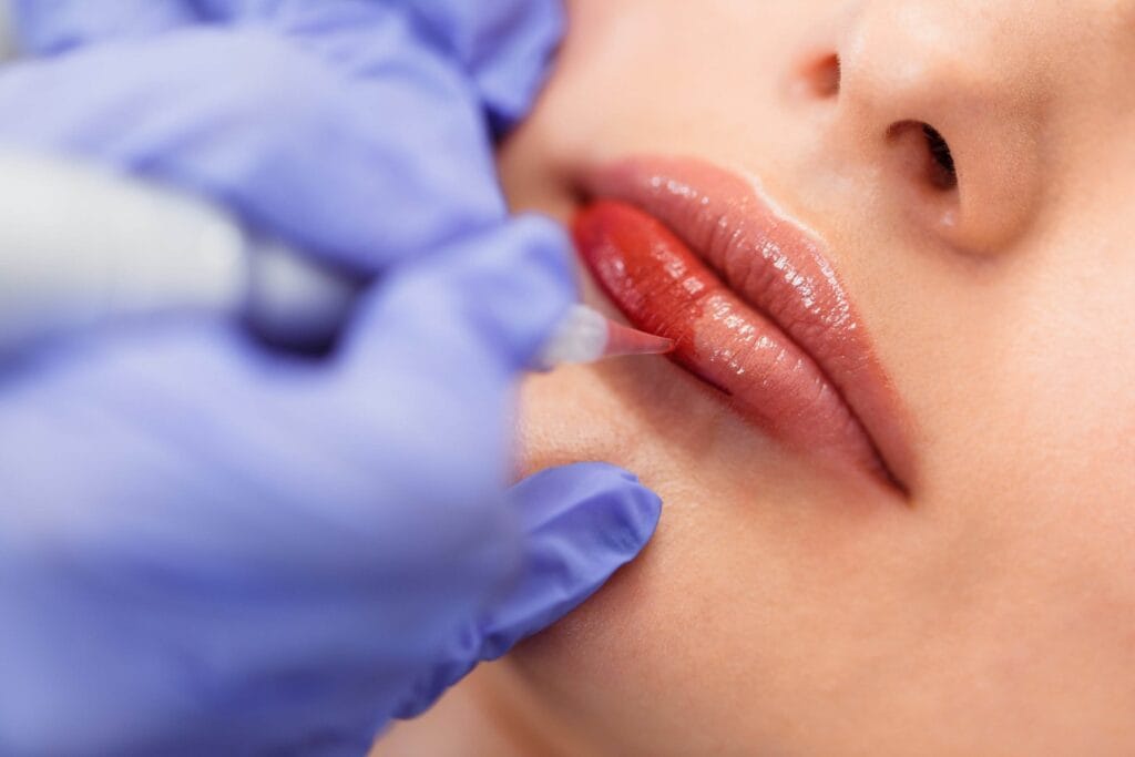 Close-up of a person's lips receiving lip blushing in East Bay. A hand wearing blue gloves holds a tool, applying red pigment for naturally enhanced lips.